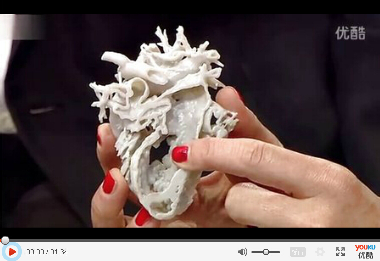 3D打印心脏模型帮助拯救2岁女孩的生命